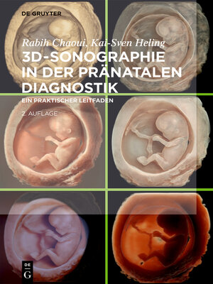 cover image of 3D-Sonographie in der pränatalen Diagnostik